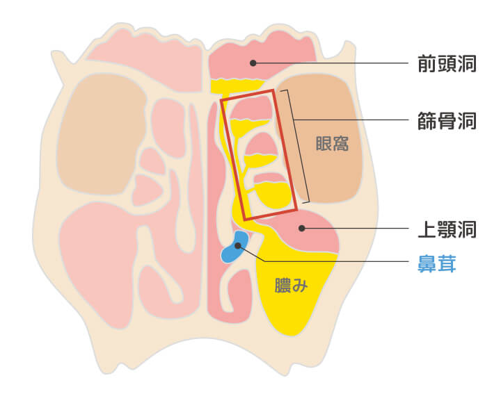 副鼻腔内視鏡手術